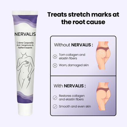 Nervalis Stretch Marks & Firming Cream